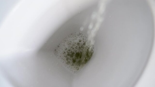 Close-up of foamy urine in a toilet bowl illustrating symptoms of proteinuria or kidney disease in a clinical health concept.