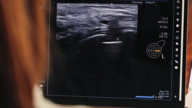 A doctor reviews a mammogram image on a computer screen in office, as part of a breast cancer screening process. High quality 4k footage