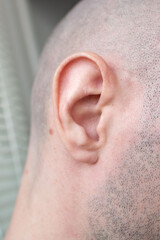Naklejka premium young caucasian man painful ear, discomfort and earache, healthcare problem, medical symptom acoustics Auditory System, Hearing Test, Cochlear implant, audiology support, ear health and deafness