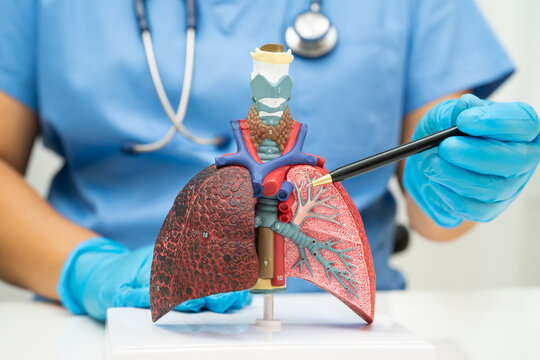 Cirrhosis, Liver cancer, fatty liver, Asian woman with liver human anatomy model.