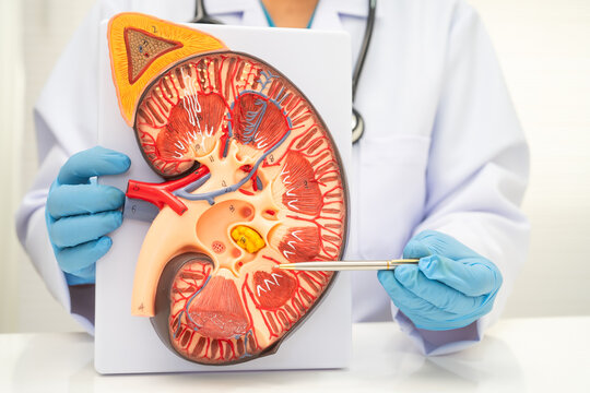 Chronic kidney disease, doctor with model for treatment urinary system, urology, Estimated glomerular filtration rate eGFR.