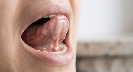 Fototapeta premium Close-up of human tongue and mouth – oral health and anatomy concept