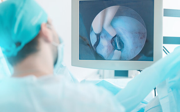 Male surgeon performing laparoscopy for prostate adenoma in operating room