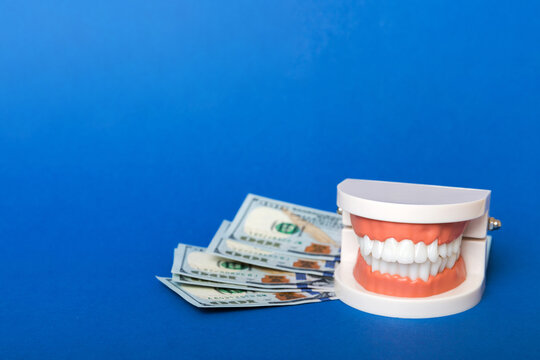 Closeup model of a human jaw with white teeth and dollar bill. Dentistry conceptual photo. Prosthetic dentistry. False teet top view with copy space