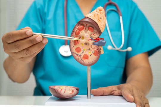 Chronic kidney disease, doctor with model for treatment urinary system, urology, Estimated glomerular filtration rate eGFR.