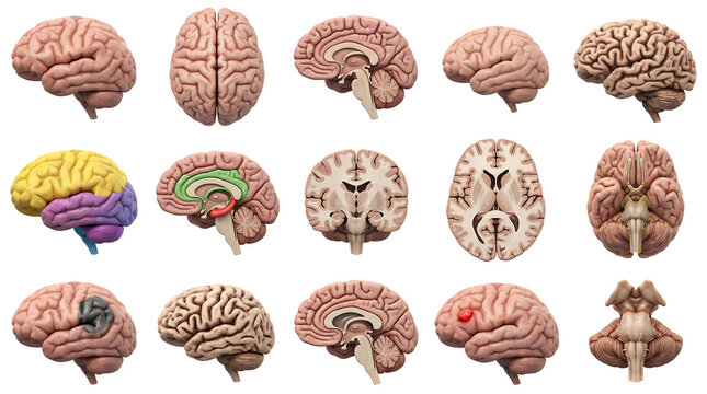 Human brain anatomy collection with lateral, sagittal, and coronal views including colored lobes and pathological lesions