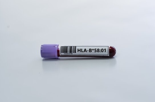 Blood sample tube for HLA-B*58:01 test analysis.