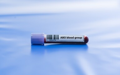 Obraz premium Blood sample tube for ABO blood group test analysis.