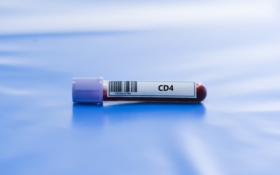 Blood sample tube for CD4 test analysis.