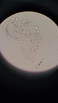 Microscopic view of Paramecium cell bursting and lysis 