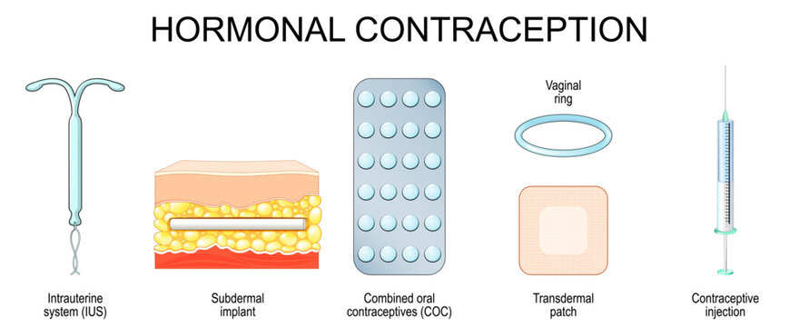 Hormonal contraception. Birth control hormones.