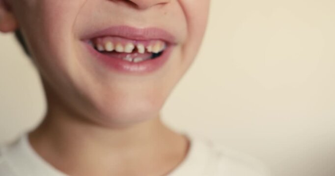 Close-up of a child smile with baby teeth showing plaque and cavities. Children dental hygiene. Dental care.