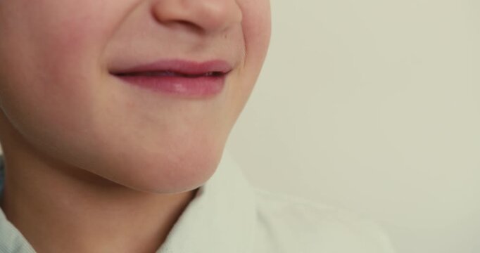 Close-up of a child smile with baby teeth showing plaque and cavities. Children dental hygiene. Dental care.