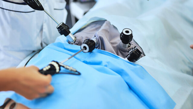 Laparoscopic surgery in progress, surgeon operating on a patient in operating room
