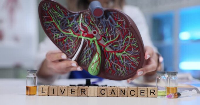 Wooden cubes arranged on table to form phrase Liver Cancer. Oncologist holds anatomical model of liver emphasizing anatomical structure and function