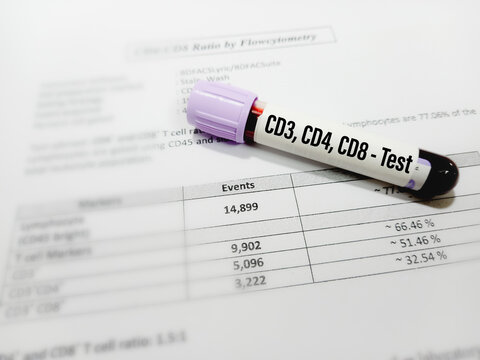 Blood sample for CD3, CD4, CD8 test (Immunity cell in HIV patient). A medical testing concept with test report background.