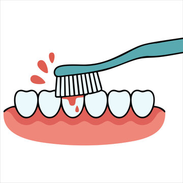 Brushing Teeth with Bleeding on Gum and Tooth Gingivitis Concept Dental Cartoon Vector