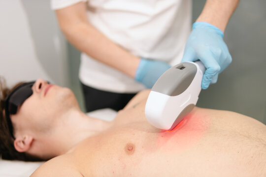 Male client undergoing professional laser hair removal treatment on his chest by a beautician in protective gloves at a modern aesthetic clinic