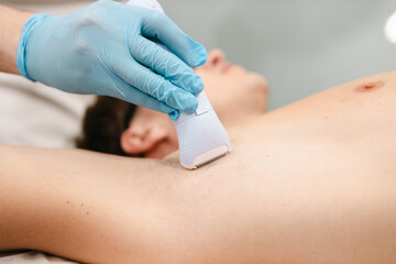 Fototapeta premium Man receiving effective laser hair removal treatment from a professional technician wearing blue gloves, targeting unwanted underarm hair for smooth skin