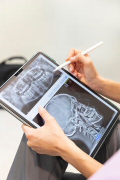 Dentist examining dental x-ray on tablet with stylus