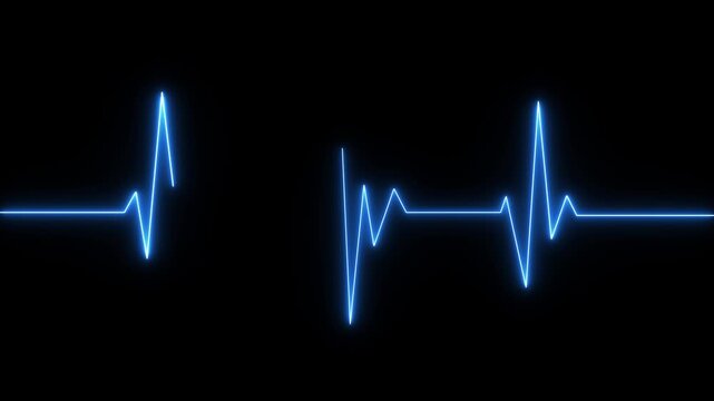 Heart failure, cardiac arrest, wave attenuation chart self drawing animation. Animated red line on black background.