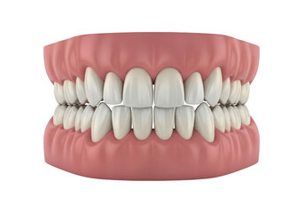 Obraz premium Detailed illustration of human teeth with dental braces isolated on transparent background