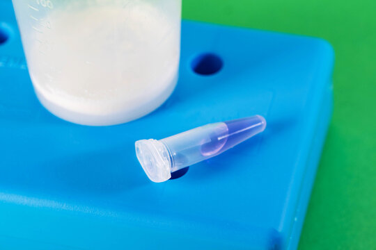 Sperm analysis of prostate fluid and ejaculate for infection and microscopy. Male infertility, presence of motile sperm, close-up