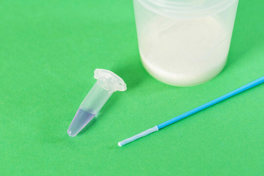 A medical swab for detecting infections that cause prostatitis and infertility. Copy space for text