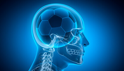 Soccer ball inside human head - medical x ray illustration - symbol of passion for sports