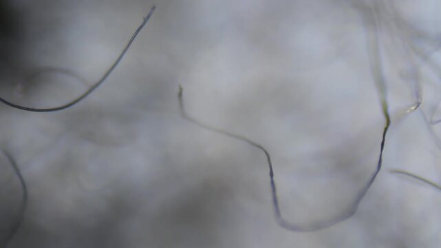 Lint filaments through an optical microscope