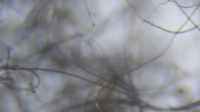 Focusing on lint threads through an optical microscope