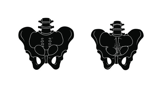 Anatomical illustration of human pelvic bones in a dark silhouette