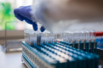 Gloved Technician Selecting Sample Vials From Rack, Workstation Bathed In Natural Light With Labeled Tubes, © flywish