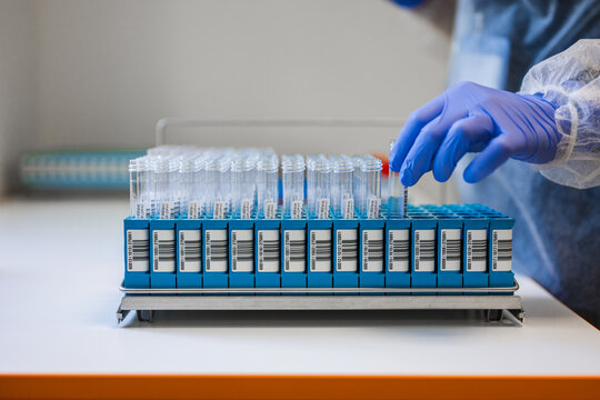 Closeup Hand Selecting Labeled Tube From Rack, Focused View On Careful Grip, Barcode Labels, Gloved Fingers,