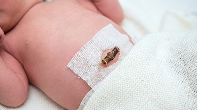 Close up of newborn baby navel with umbilical cord stump and medical gauze, neonatal care and health concept, infant belly hygiene
