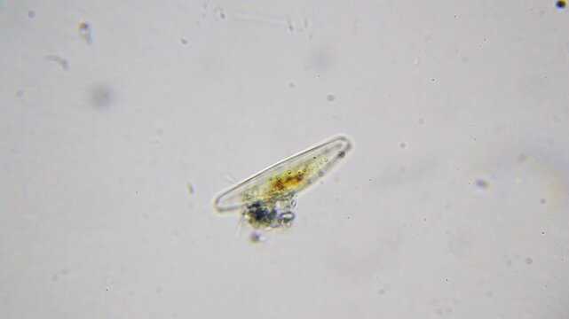 Immobile diatom algae under 400x bright field microscopy. 4K scientific microscopy footage.