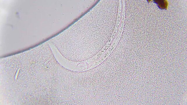 Nematode and ciliate surrounded by dense bacterial colony under 100x bright field microscopy. 4K scientific microscopy footage.