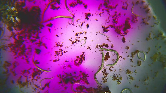 Multiple nematodes in colored liquid with sand particles under 40x bright field microscopy. 4K scientific microscopy footage.