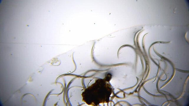 Multiple nematodes at edge of water droplet under 40x bright field microscopy. 4K scientific microscopy footage.