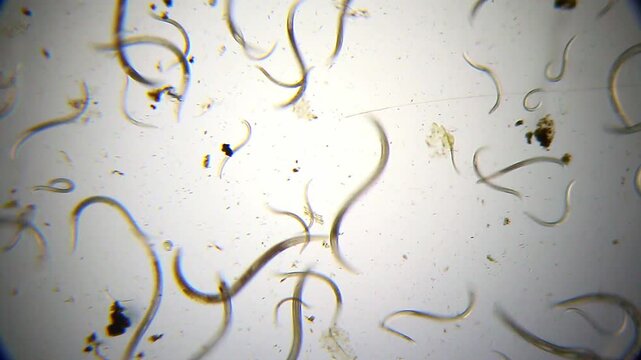 Multiple nematodes in panoramic view under 40x bright field microscopy. 4K scientific microscopy footage.
