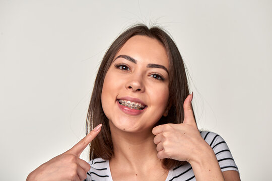 Young white adult woman one person with dental braces smiling pointing at teeth and showing thumbs up indoors studio. Concept of dental success, approval and confidence after orthodontic treatment