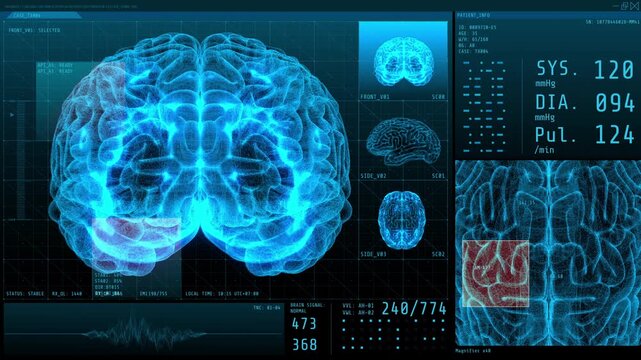 X-ray image of human brain with global digital technology and medical concept