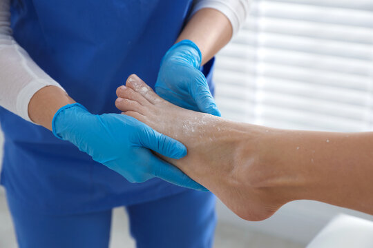 Podologist in medical gloves applying talcum powder onto patient's foot in clinic, closeup