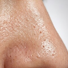 Fototapeta premium Close-up view of oily facial skin texture, showing visible pores and minor imperfections around the nose area