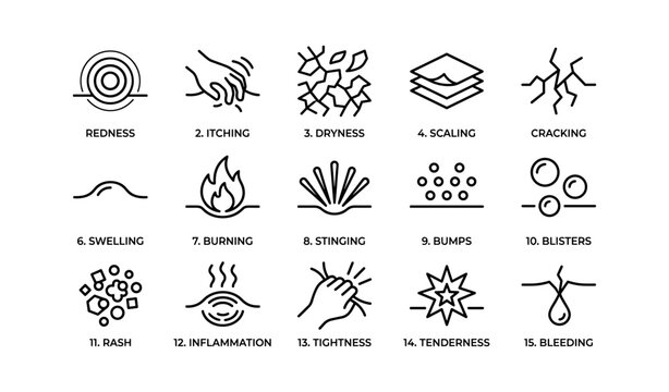 15 skin conditions: redness, itching, dryness, scaling, cracking, swelling, burning, stinging