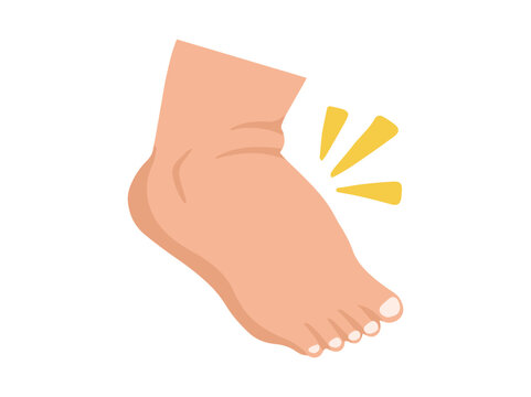 Hand Drawn Edema Foot Disease Illustration
