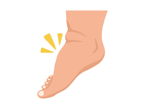 Edema Foot Healthcare Illustration
