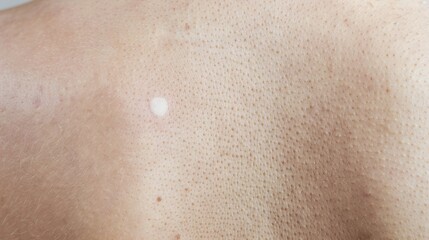 Fototapeta premium Leukoplakia: Clinical Features, Pathological Diagnosis, Malignant Risk and Management in Oral Medicine