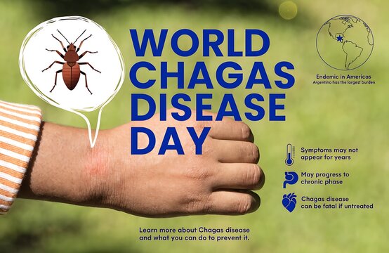 World Chagas Disease Day Awareness Poster Showing Kissing Bug Bite On Arm And Public Health Message

