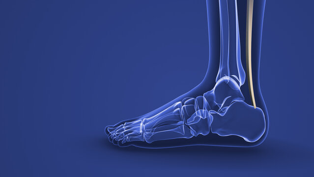 Achilles Tendon Strain Causing Ankle Pain